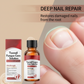 🖤Des résultats concrets plus rapides🖤 2 flacons d'essence réparatrice pour ongles abîmés💅🏻