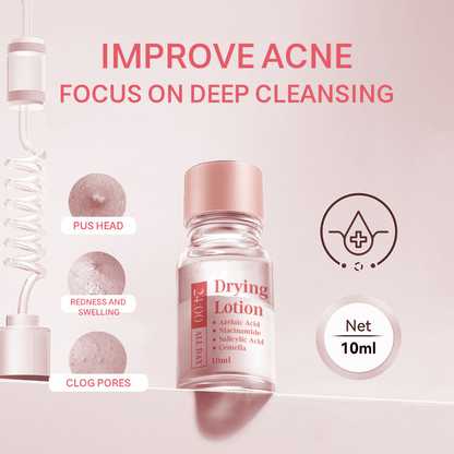 🌟70% de réduction🌟 Lotion asséchante à l'acide salicylique - Traitement de nuit rapide